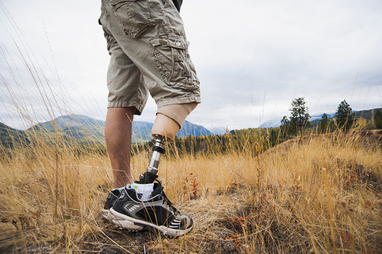 Rocky Mountain Prosthetics &amp; Orthotics
